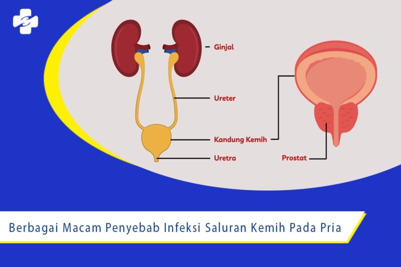 Berbagai Macam Penyebab Infeksi Saluran Kemih Pada Pria