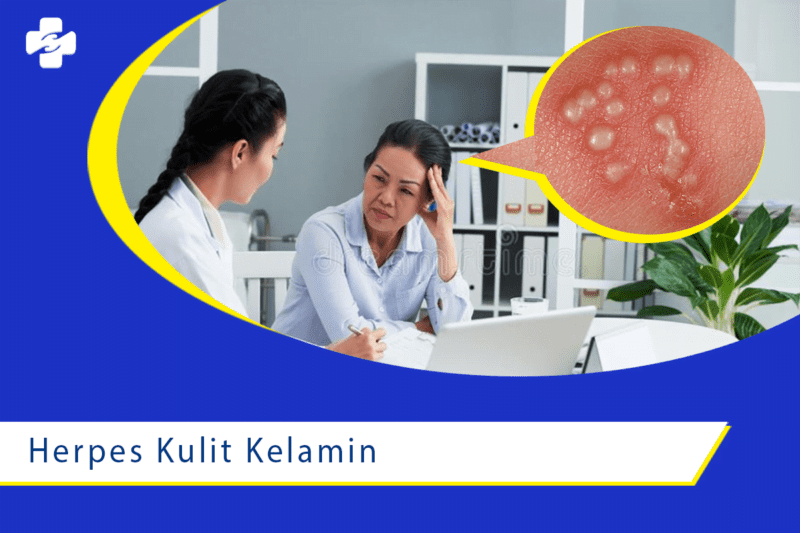 Kenali Herpes Kulit Kelamin Yuk Klinik Utama Sentosa