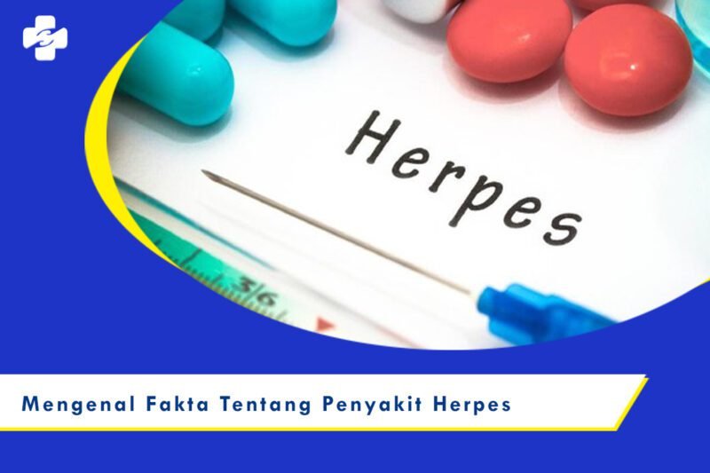 Mengenal Fakta Tentang Herpes Klinik Utama Sentosa