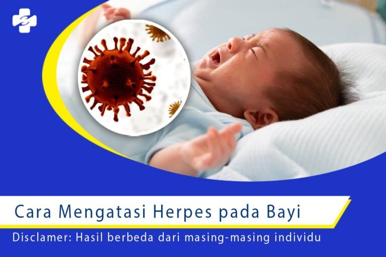 Cara Mengatasi Herpes Pada Bayi Klinik Utama Sentosa