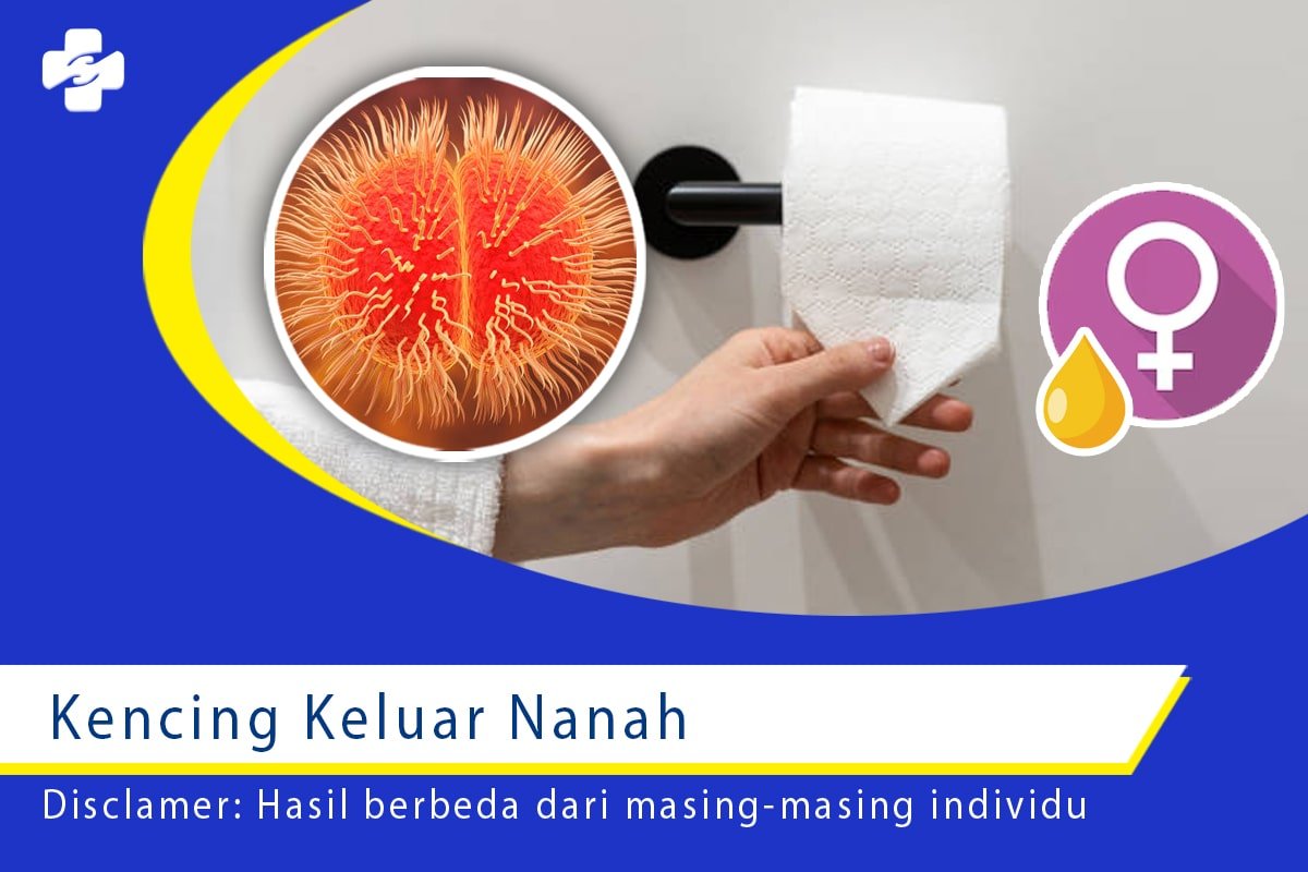 Periksa Kencing Keluar Nanah Bisa Cepat Klinik Utama Sentosa