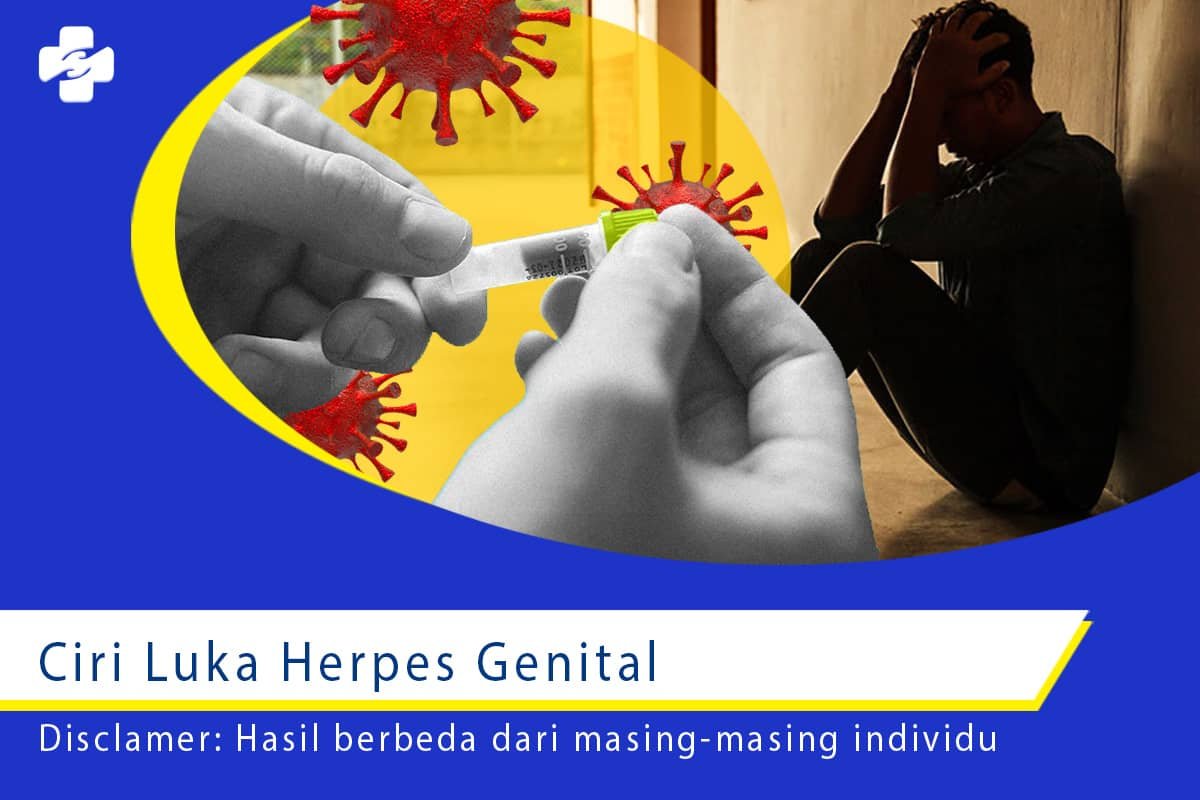 Beginilah Ciri Luka Herpes Genital Lihat Klinik Utama Sentosa