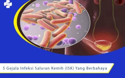 5 Gejala Infeksi Saluran Kemih (ISK) Yang Berbahaya