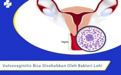 Vulvovaginitis Bisa Di Sebabkan Oleh Bakteri Loh