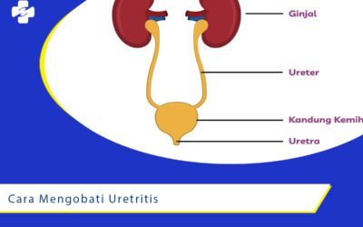 Cara Mengobati Uretritis