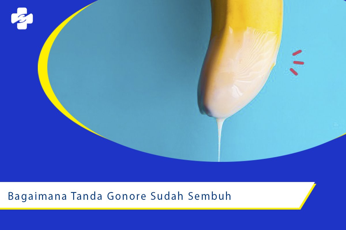Bagaimana Tanda Jika Gonore Sudah Sembuh