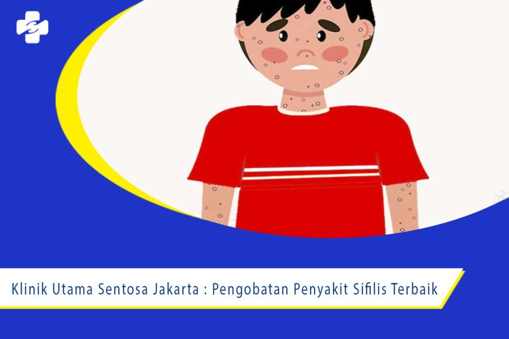 Klinik Utama Sentosa Jakarta : Pengobatan Penyakit Sifilis Terbaik