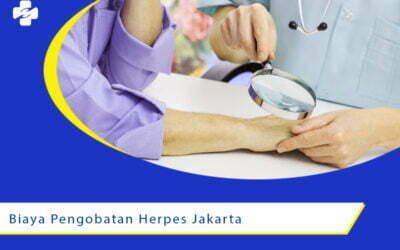 Biaya Pengobatan Herpes di Jakarta Utara