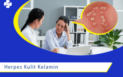 Kenali Herpes Kulit Kelamin Yuk