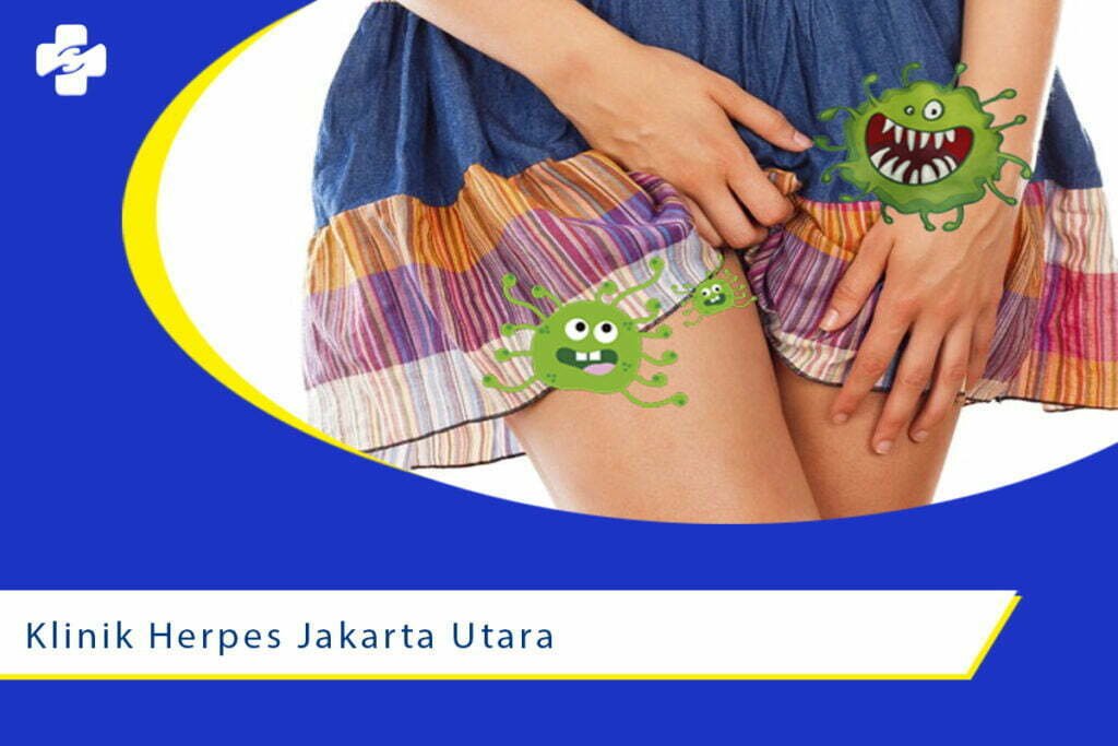 Klinik Herpes di Daerah Jakarta Utara