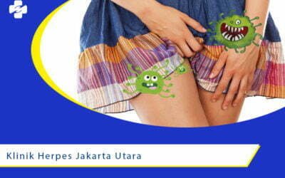 Klinik Herpes di Daerah Jakarta Utara