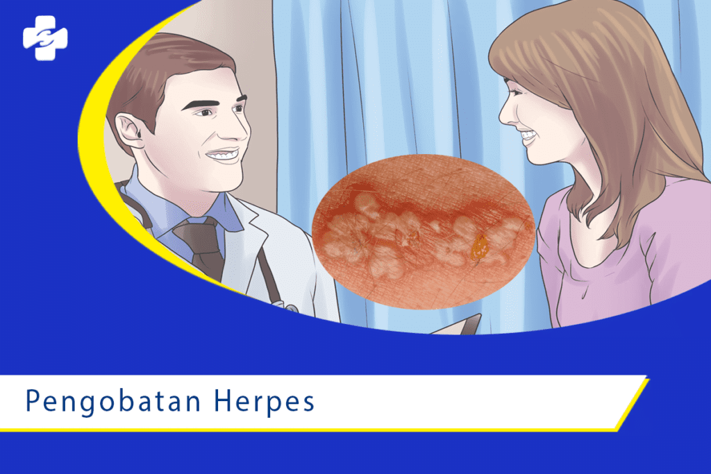 Butuh Berapa Lama Pengobatan Herpes?