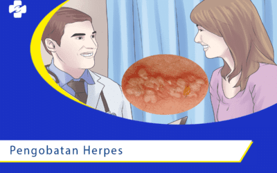 Butuh Berapa Lama Pengobatan Herpes?