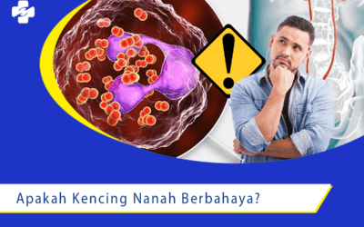 Waspada! Apakah Kencing Nanah Berbahaya?