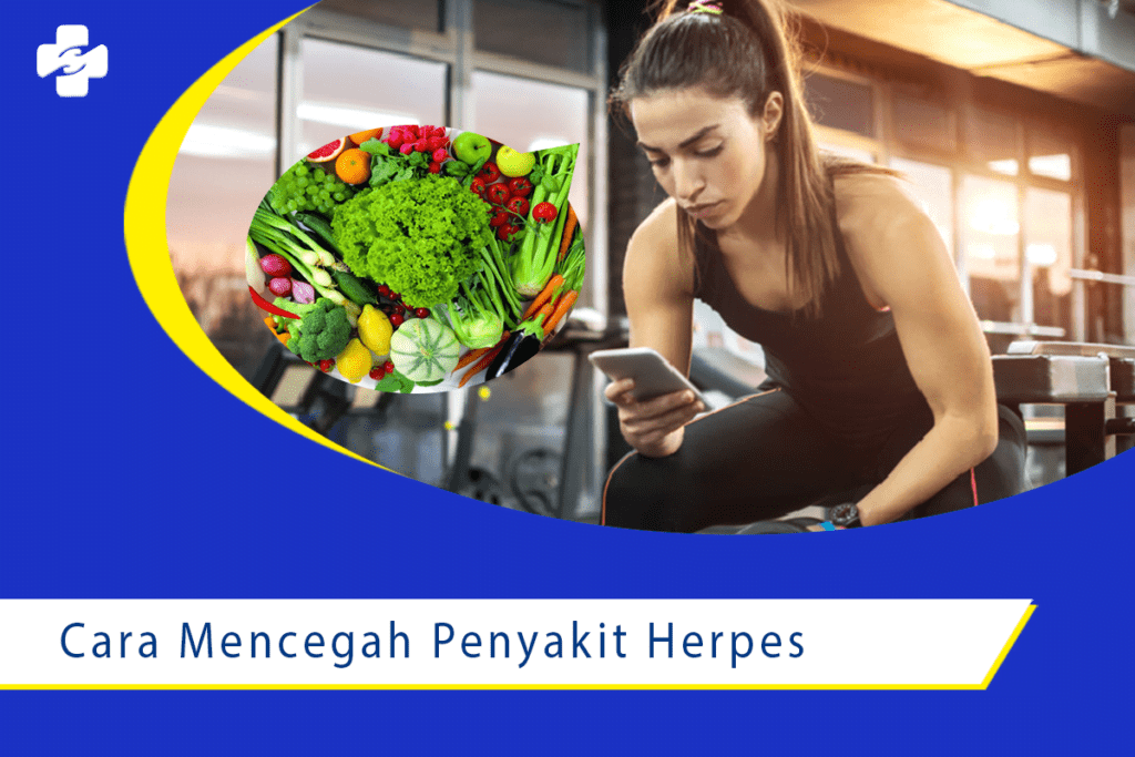 Cara Mencegah untuk Penyakit Herpes