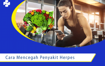 Cara Mencegah untuk Penyakit Herpes