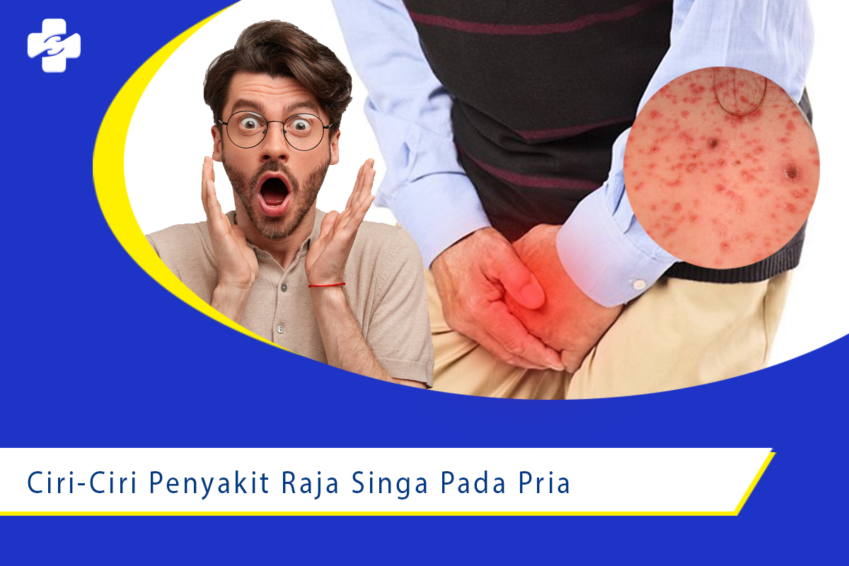 Ciri Ciri Gejala Penyakit Raja Singa Pada Pria Klinik Utama Sentosa