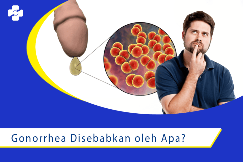 Penyebab dari Penyakit Gonorrhea