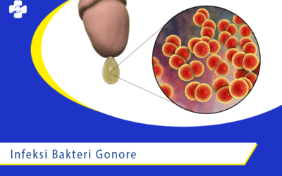 Ini Dia Penyebab dari Infeksi Bakteri Gonore