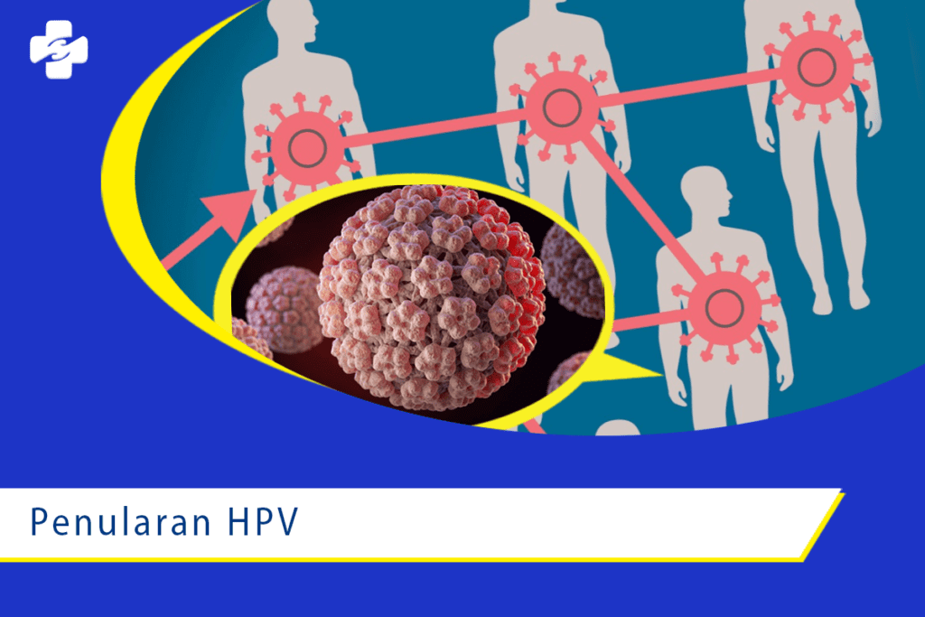 Cari Tahu Bagaimana Penularan HPV