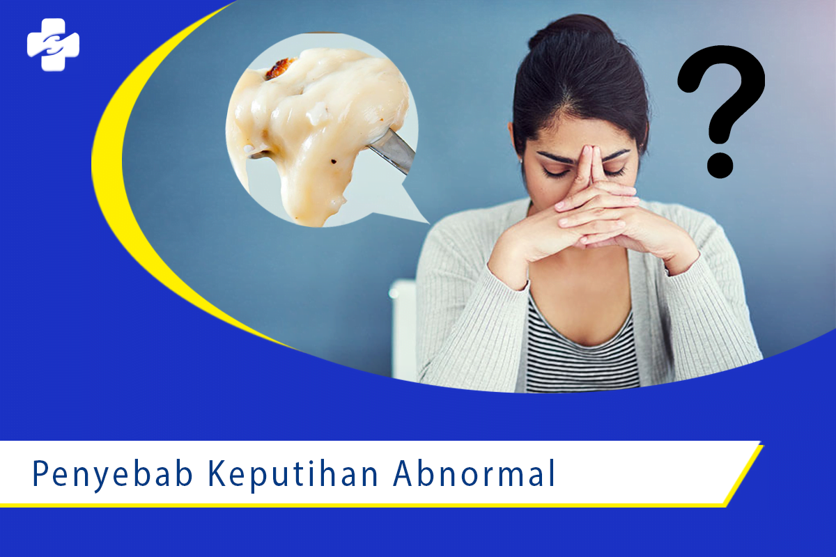 Ketahui Penyebab Keputihan Abnormal Pada Wanita