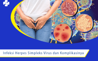 Wapadai Komplikasi dari Herpes Simplex Virus  