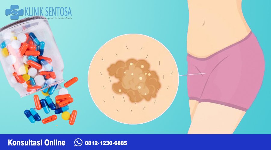 Anda bisa ke klinik terpercaya untuk penyakit dalam seperti Klinik Sentosa Jakarta untuk melakukan pengobatan kutil kelamin