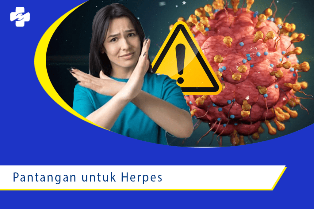 Pantangan Penyakit Herpes yang Harus Dilakukan