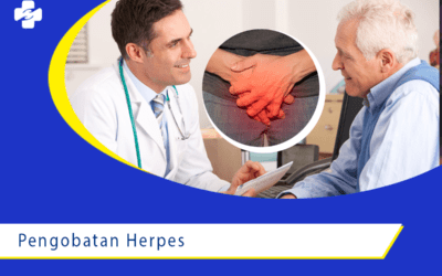 Pengobatan Herpes