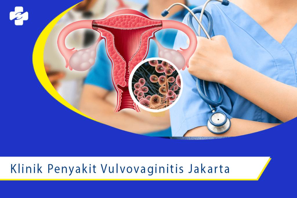 Klinik untuk Penyakit Vulvovaginitis Daerah Jakarta