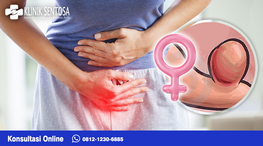 Gangguan kutil kelamin biasanya muncul sebagai benjolan kecil atau tonjolan pada area genital. 