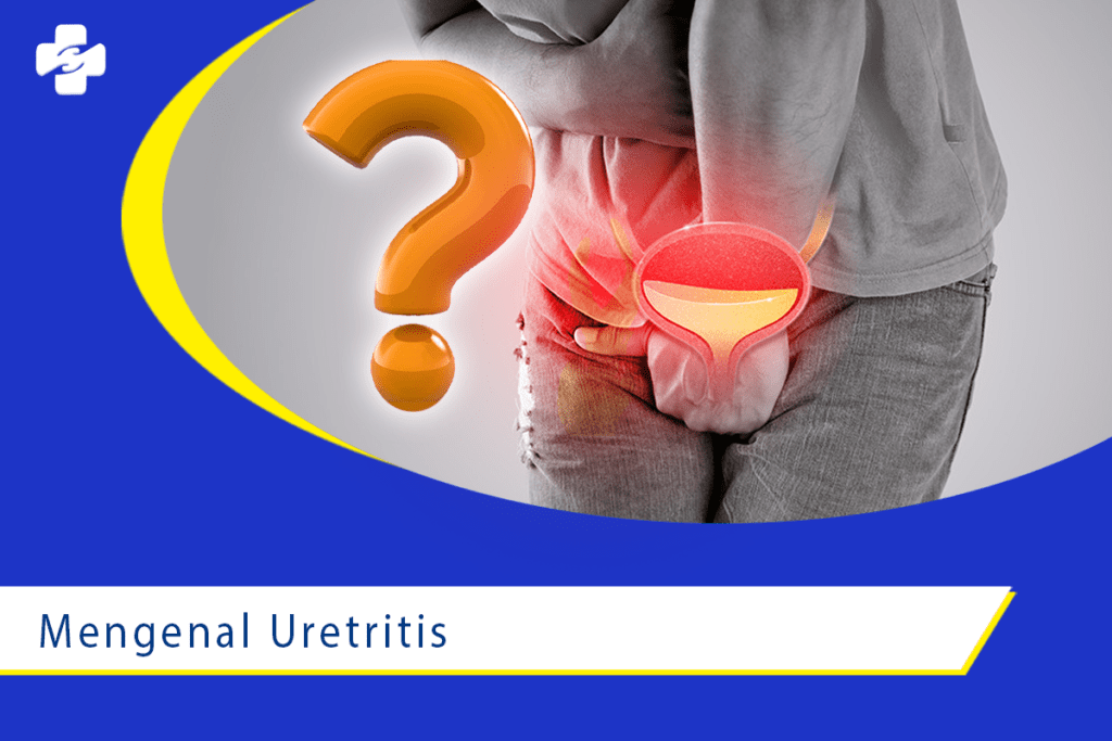 Mengenal Uretritis dari Dokter Ahli Terbaik