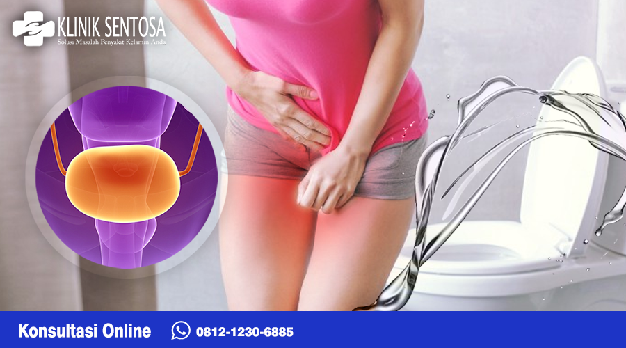 Uretritis adalah kondisi medis yang menyebabkan peradangan pada uretra, yaitu saluran yang membawa urine dari kandung kemih ke luar tubuh. 