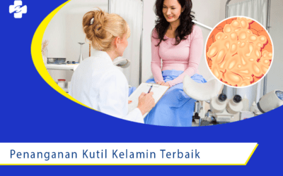 Penanganan Kutil Kelamin Terbaik oleh Ahlinya