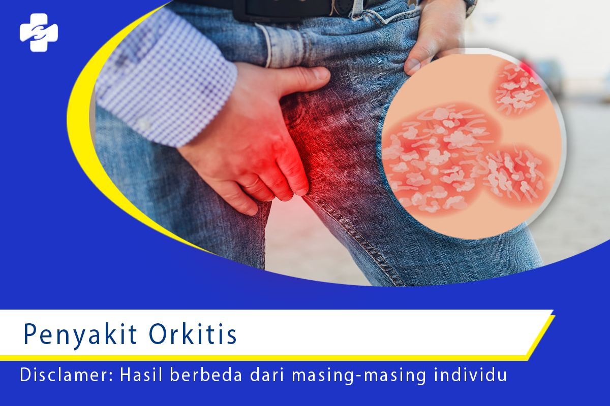 Mengenal Penyakit Orkitis Atau Radang Testis Klinik Utama Sentosa