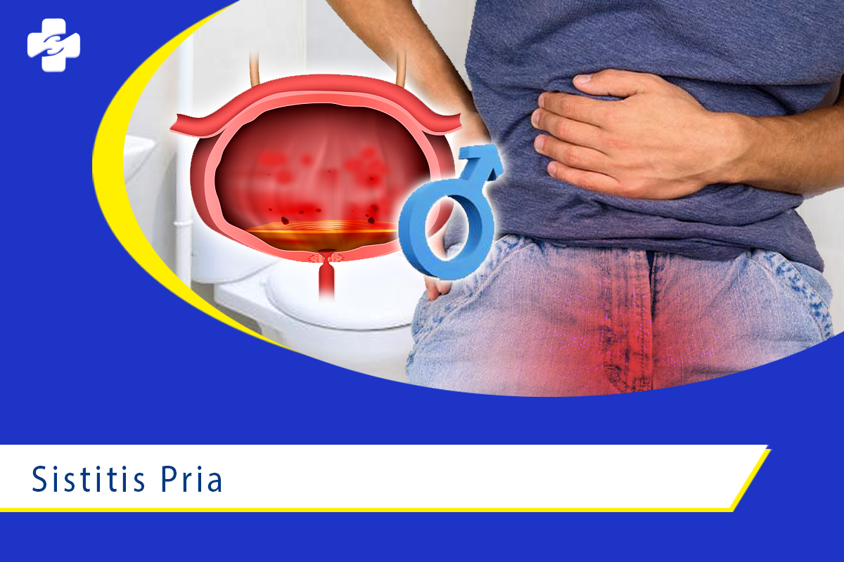 Sistitis Pria, Bahaya atau Tidak? | Klinik Utama Apollo