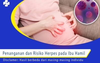 Penanganan dan Risiko Herpes pada Ibu Hamil