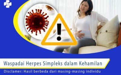 Waspadai Herpes Simpleks dalam Kehamilan