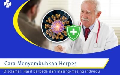 Cara Menyembuhkan Herpes Bagaimana Langkahnya