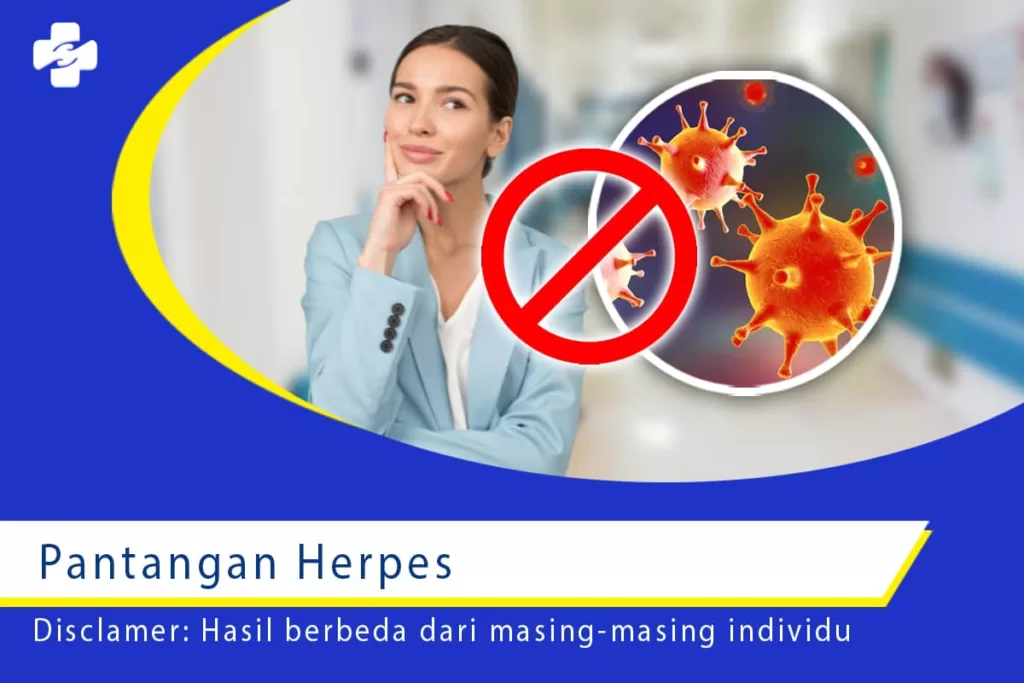 Taati dan Lakukan Pencegahan Ini dari Pantangan Herpes