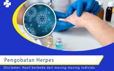 Deretan Pengobatan Penyakit Herpes