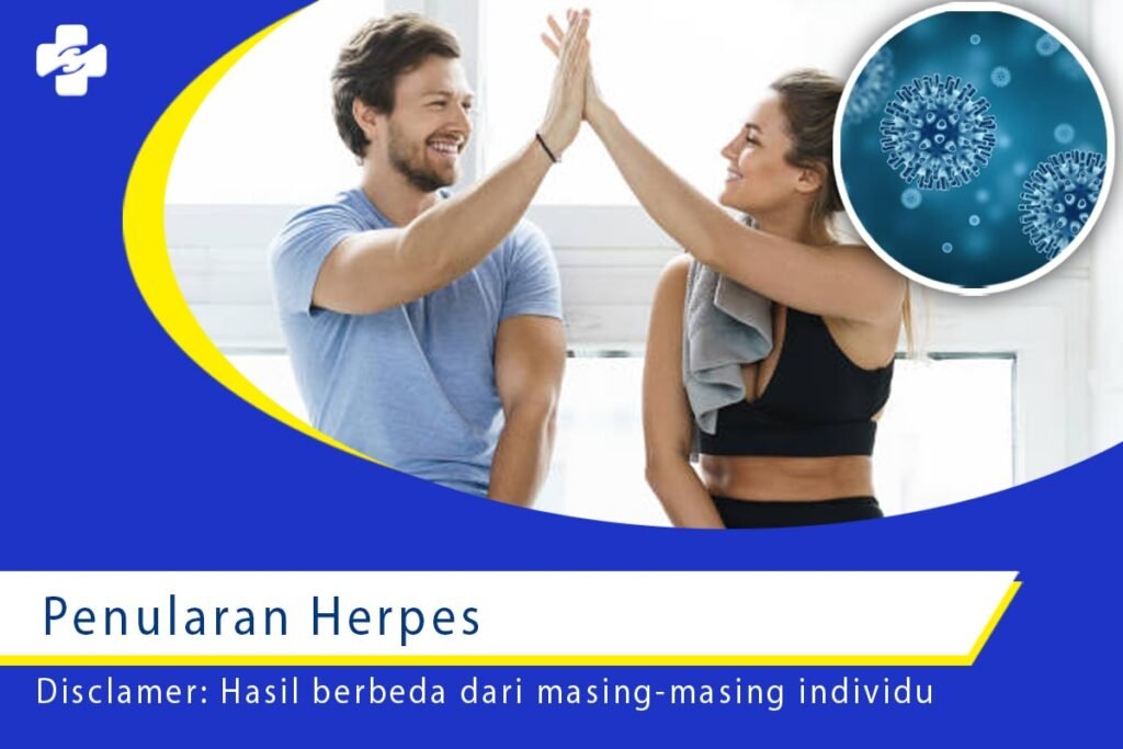Mengetahui Berbagai Cara Penularan Herpes