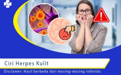 Ciri Herpes Kulit 1