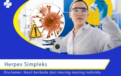 Herpes Simpleks