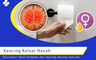 Kencing Keluar Nanah
