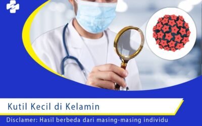 Beda Kutil Kecil di Kelamin dan Kutil Lainnya
