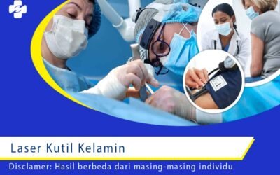 Keunggulan Laser Kutil Kelamin, Pasti Aman?