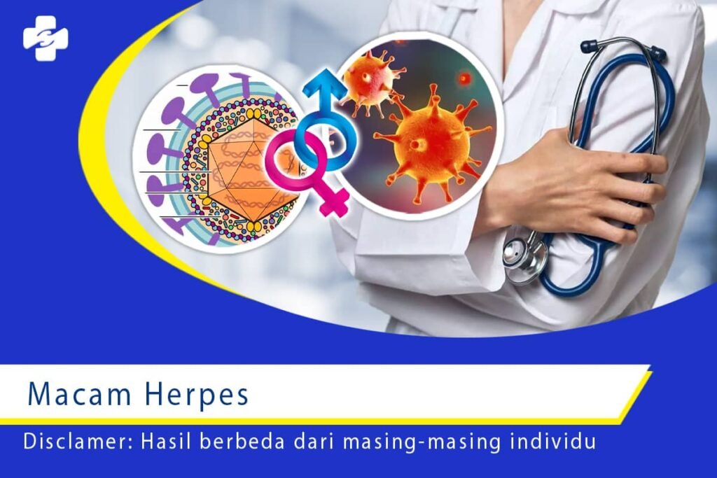 Macam Herpes 1
