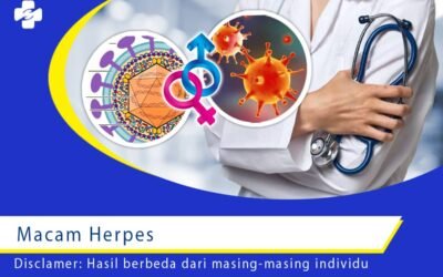 Macam Herpes 1