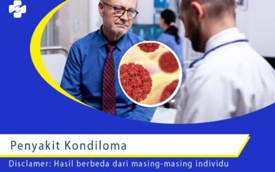 Penyakit Kondiloma